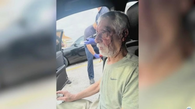 一名67岁的休斯敦男子因试图上错车而被两名男子恶毒殴打这名男子患有阿尔茨海默病